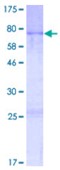 SDS-PAGE (AVEN-1041H).jpg